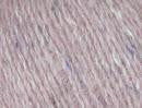 Felted Tweed DK - Image 23